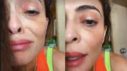 Juliana Paes surge com o olho inflamado - Foto: Reprodução / Instagram