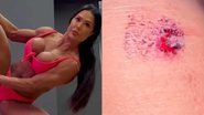 Gracyanne Barbosa sofre acidente e mostra machucado - Reprodução/Instagram